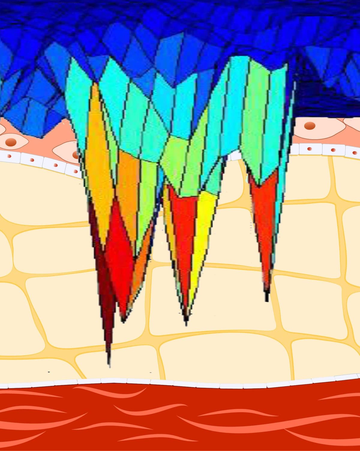 MULMI: several ultrasound lobes with a dispersed focus in the tissue below the skin